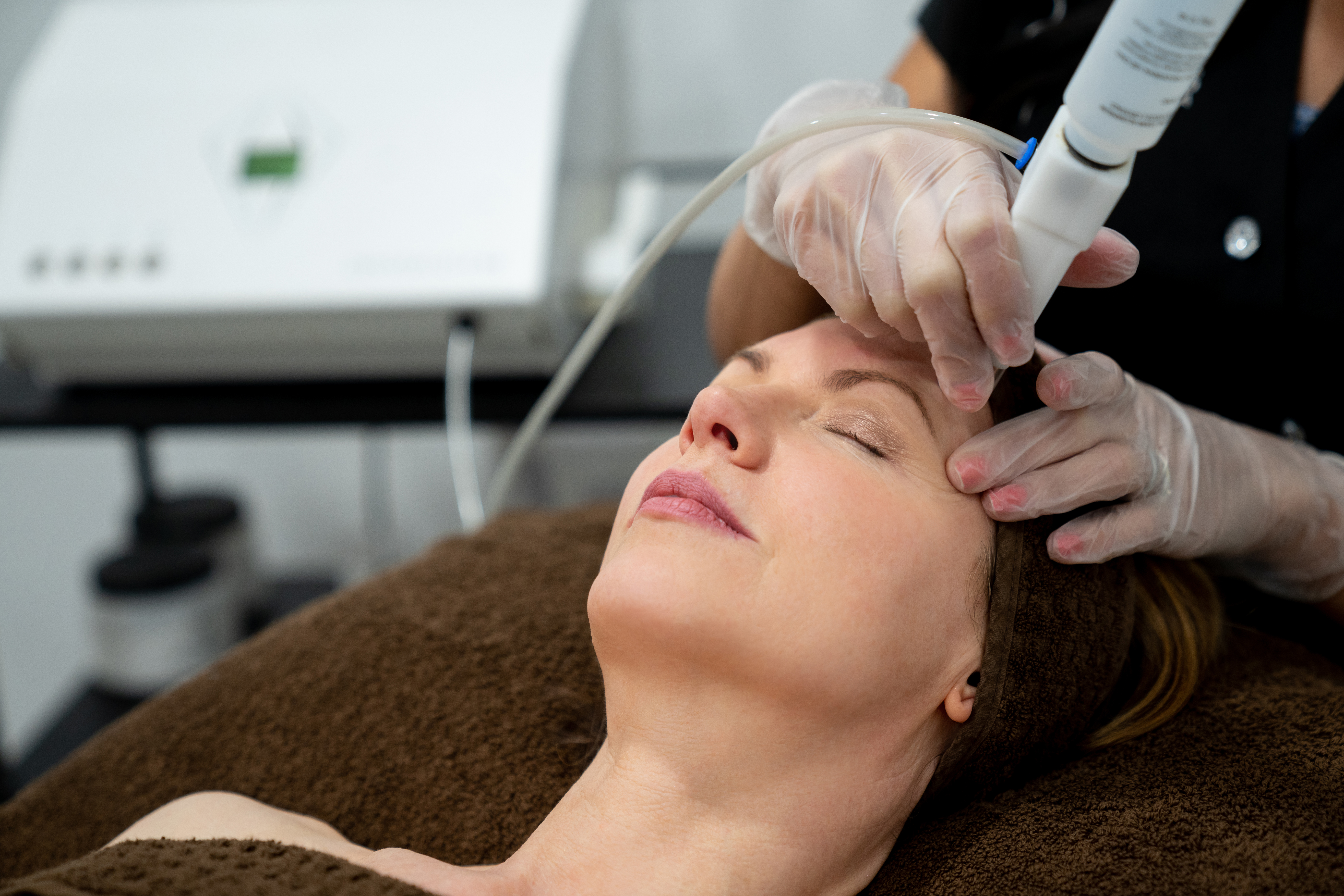 Laser Skin Rejuvenation in Birmingham, AL