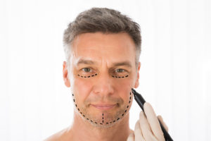 Plastic Surgery in Birmingham, AL